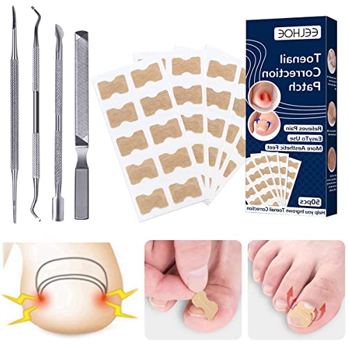 Ingrown Toenail Correction Patch Ingrown Toenail Sticker Patch 50PCS Nail Correction Sticker with 4PCS Nail Correction Tool,Glue-Free Toenail Cor