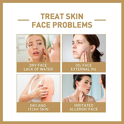 Rice Toner 150ml, Rice Water Toner for Face Hydrating,Natural Glow Essence Toning Solution with Rice Extract,Soothing Toner for Deep Hydration Sk