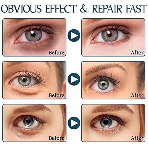 Eveellyn Under Eye Patches, Collagen Under Eye Masks 30 Pair, Eye Masks for Puffy Eyes, Dark Circles, Eye Bags, Improve Lines and Wrinkles Eye Ca