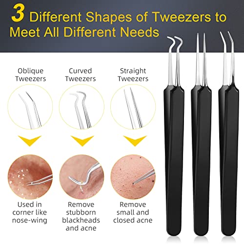 Blackhead Remover Tool Kit, IUMAKEVP 15 PCS Professional Stainless Steel Pimple Popper Comedone Extractor Tools for Removing Pimples, Blackheads,