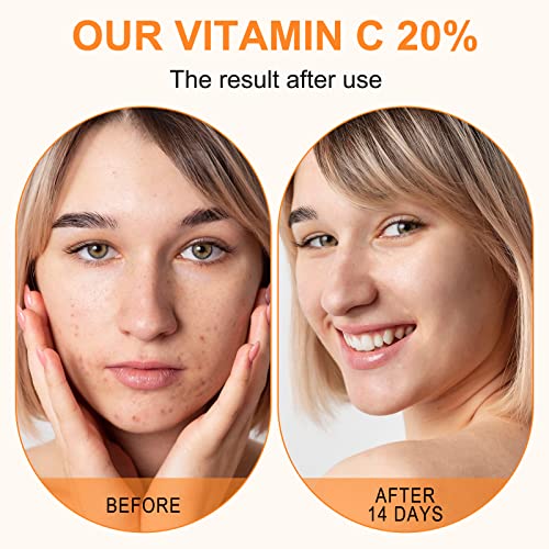 ELBBUB Premium 20% Vitamin C Serum For Face with Hyaluronic Acid, Retinol & Amino Acids - Boost Skin Collagen, Brighten Hydrate & Plump Skin, Ant