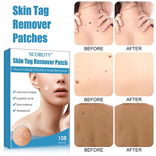 CBROSEY Skin Tag Removal Patches,Mole Remover,Acne Pimple Master Patch