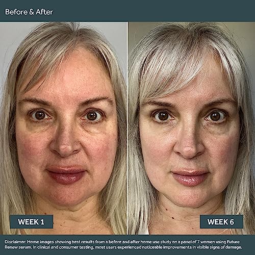 No7 Future Renew Damage Reversal Serum 25ml