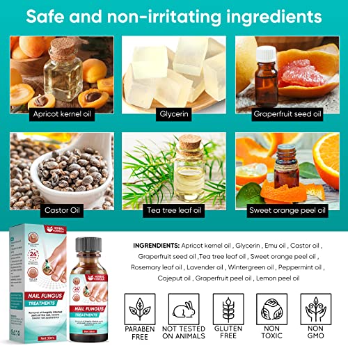 Chinoxia Fungal Nail Treatment, Extra Strong Nail Fungus Treatment for Toenail, Nail Repair Kit with File and Brush -30ml