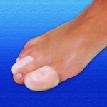 Silipos | 100% All Gel | Digital Toe Caps x2 | Pure Gel Toe Protection | Conditions & Softens | Protects against Pressure & Friction | Large / X