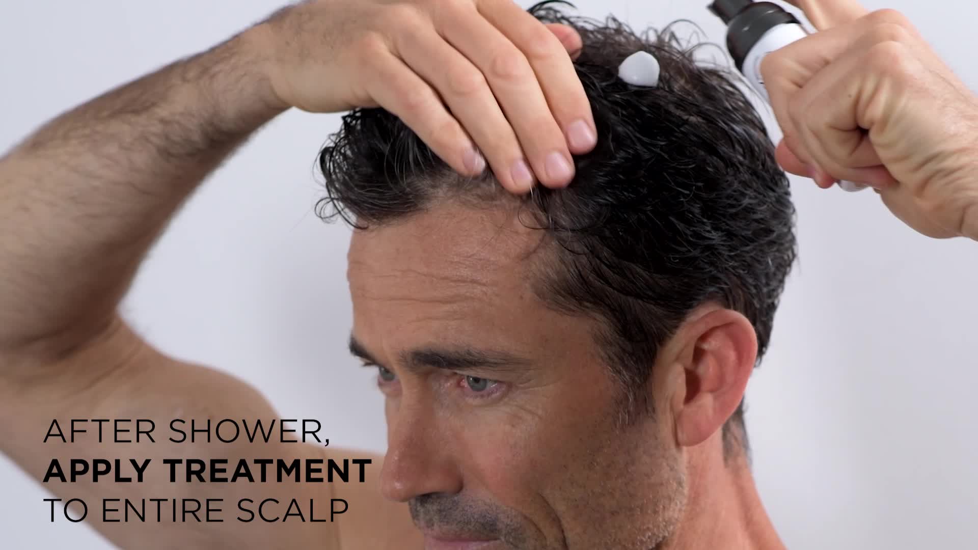 Nioxin 3-Part System, System 6, Chemically Treated Hair with Progressed Thinning Scalp & Hair Treatment